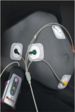 Positioning of the ECG electrodes on mother's abdomen in order to record  fetal heart recording